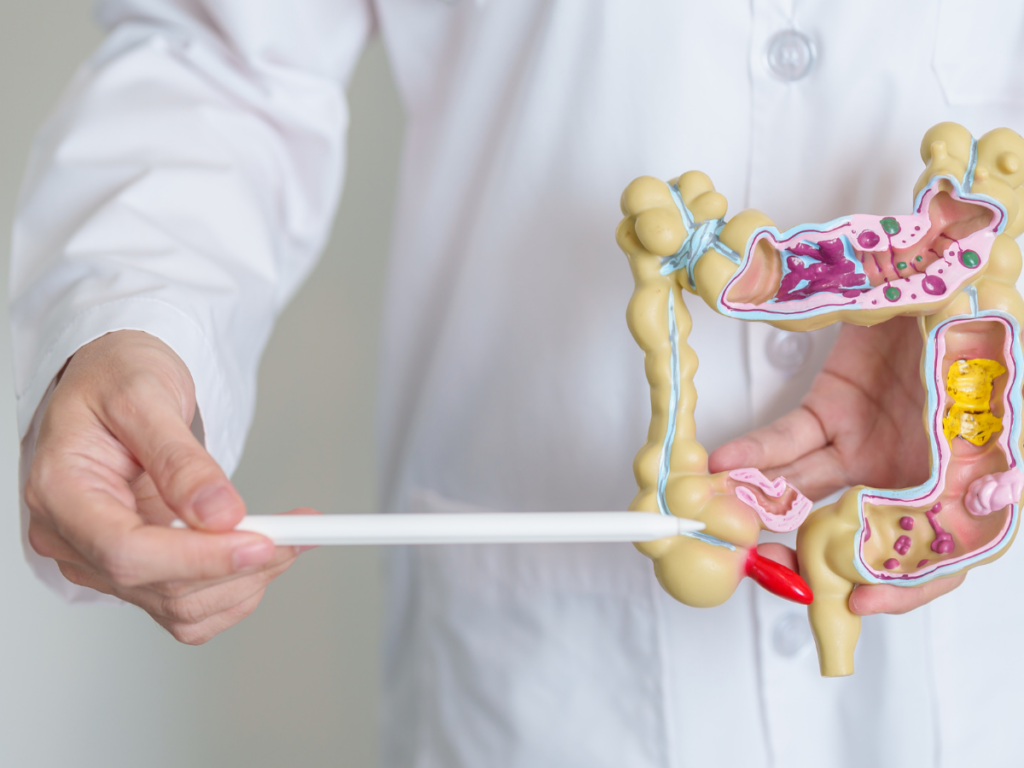 Como identificar a Síndrome do Intestino Irritável?