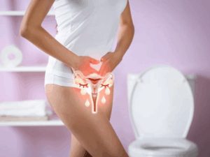 Candidíase de Repetição:como a alimentação ajuda na prevenção e no tratamento