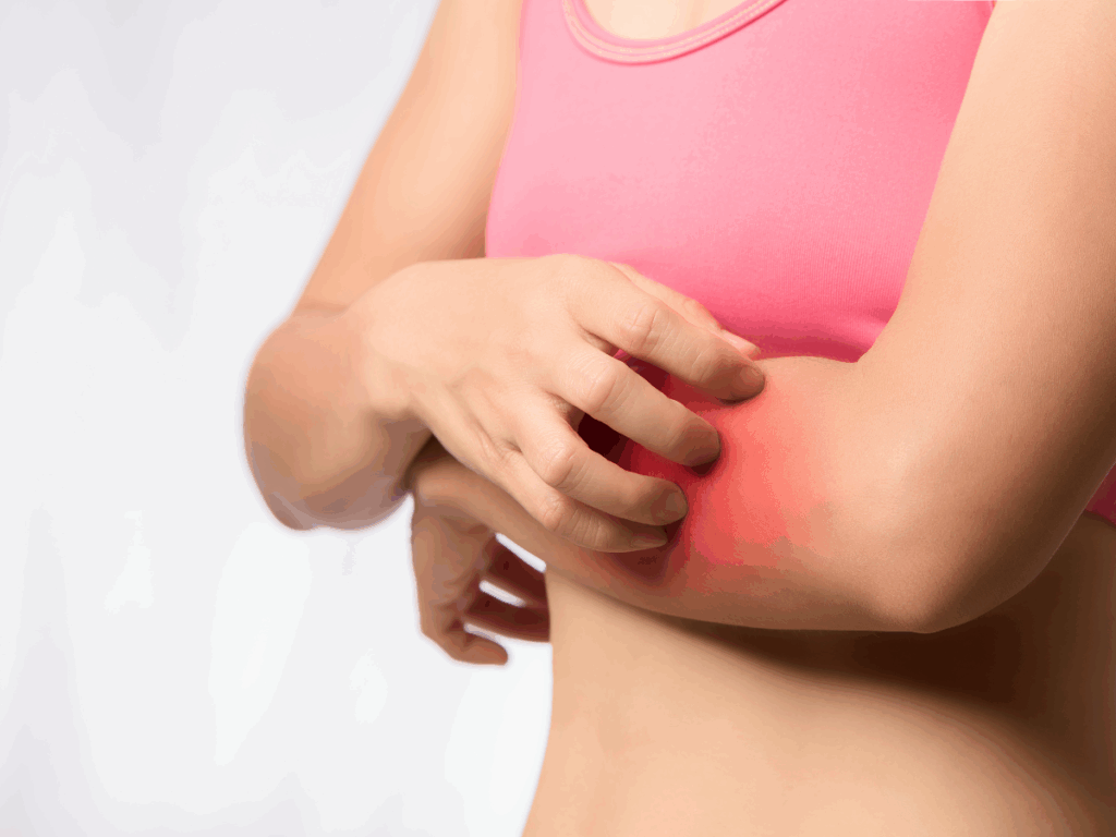 Intolerância a Histamina: O que é, causas e tratamento